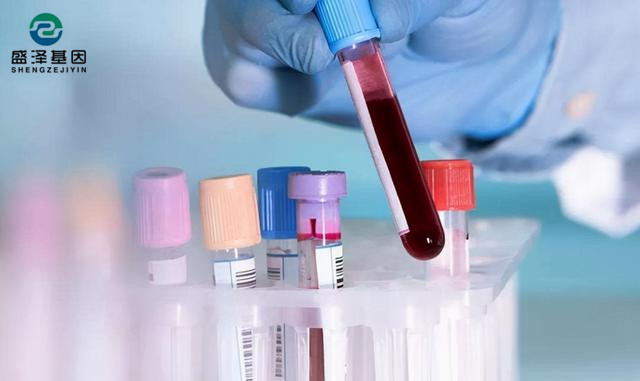 做親子鑒定父母都要驗血嗎？鑒定親子關系流程有哪些？