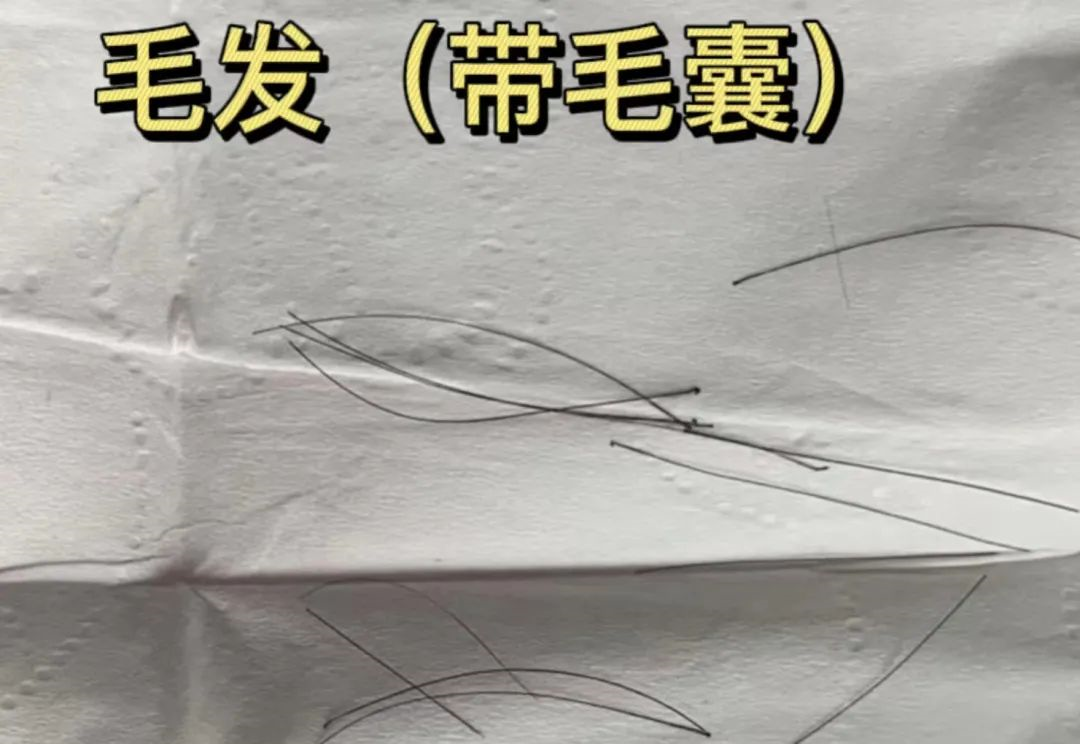 親子鑒定樣本采集棉棒上的血痕可以嗎？