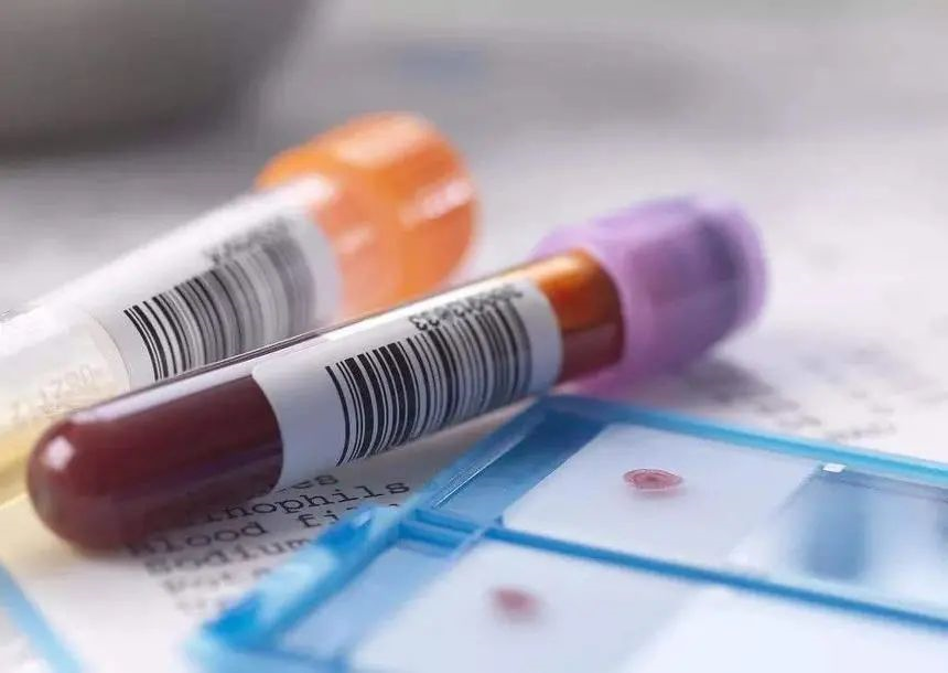 親子鑒定和血型有關系嗎？給孩子做親子鑒定需要什么樣本？