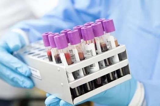 胎兒還沒有生下來能不能做親子鑒定采集羊水？