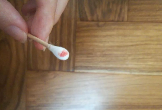 煙頭、血痕、毛發，做親子鑒定用哪些樣本最為準確？