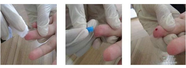 在家怎樣做親子鑒定最簡(jiǎn)單？毛發(fā)樣本采集好后放入標(biāo)記好的信封內(nèi)