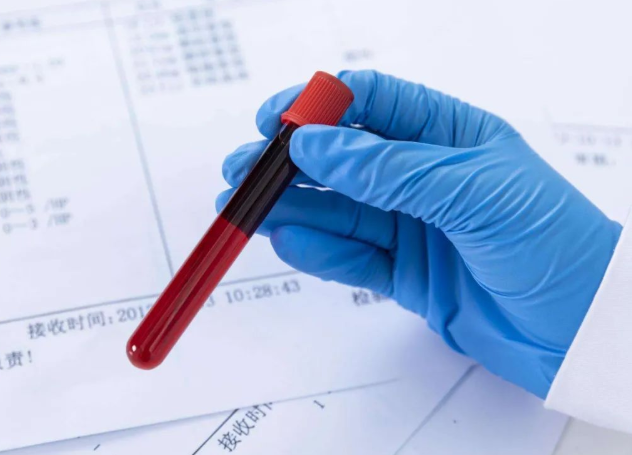 兄妹之間可以做親子鑒定嗎?兄弟之間可以做親緣關系鑒定嗎? 兄妹之間可以做親子鑒定嗎?兄弟之間可以做親緣關系鑒定嗎?