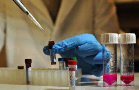 對比血清分類學測試和白細胞抗原測試,親子(緣)鑒定靠不靠譜? 對比血清分類學測試和白細胞抗原測試,親子(緣)鑒定靠不靠譜?